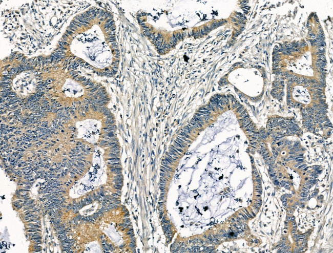 KCNN3 Antibody in Immunohistochemistry (Paraffin) (IHC (P))