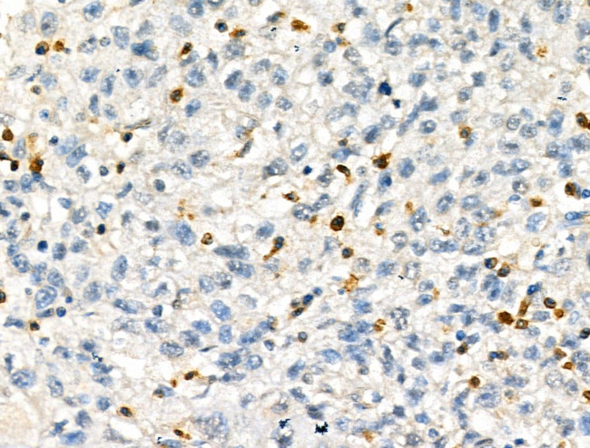 JMJD2A Antibody in Immunohistochemistry (Paraffin) (IHC (P))