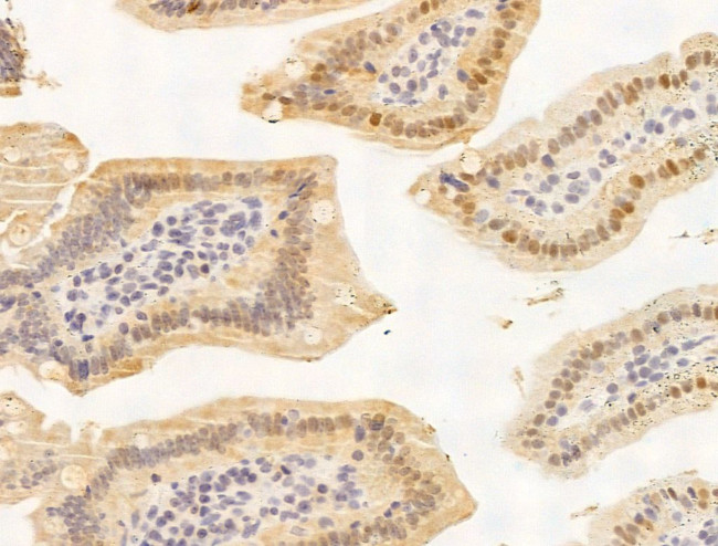 JARID1C Antibody in Immunohistochemistry (Paraffin) (IHC (P))