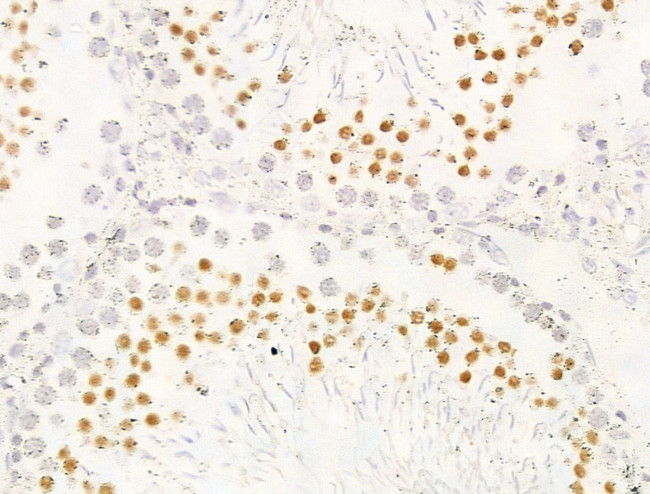 JARID1C Antibody in Immunohistochemistry (Paraffin) (IHC (P))