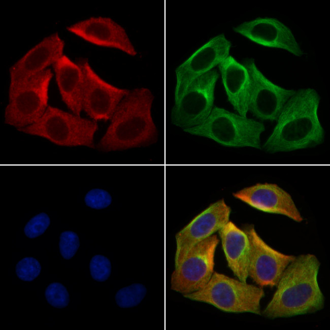 KGF Antibody in Immunocytochemistry (ICC/IF)