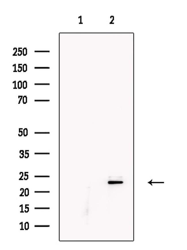 KGF Antibody in Western Blot (WB)