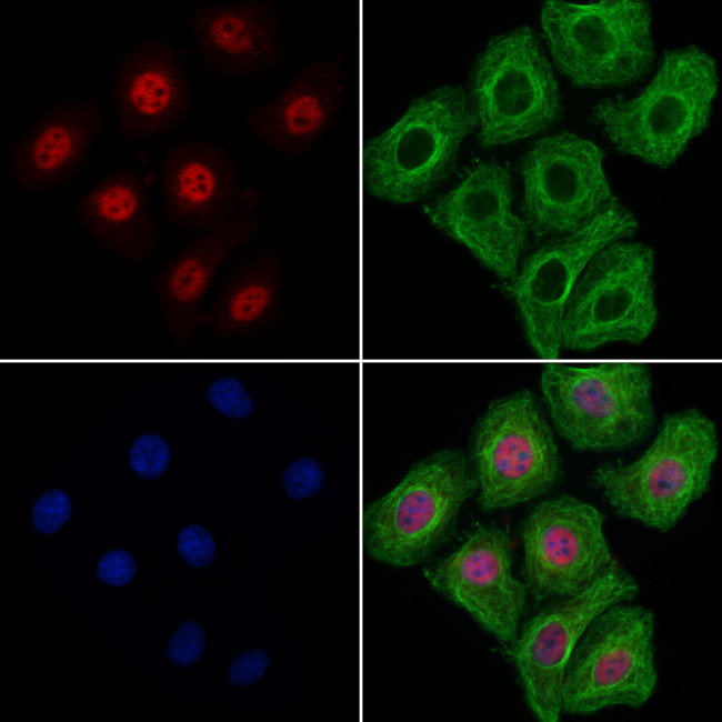 KIF17 Antibody in Immunocytochemistry (ICC/IF)