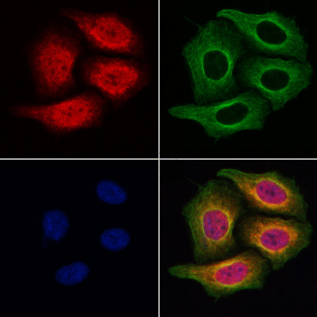 KIF4A Antibody in Immunocytochemistry (ICC/IF)