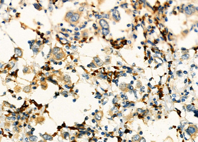 KIF4A Antibody in Immunohistochemistry (Paraffin) (IHC (P))