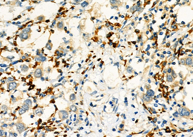 KIF4A Antibody in Immunohistochemistry (Paraffin) (IHC (P))