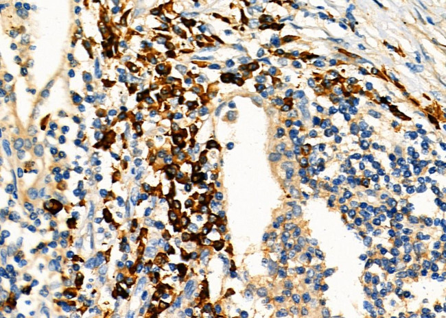 KIF4A Antibody in Immunohistochemistry (Paraffin) (IHC (P))