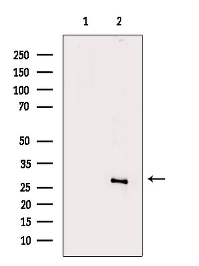 KIR2DL4 Antibody in Western Blot (WB)