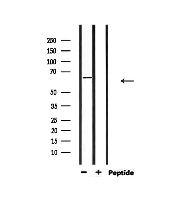 Epstein Barr Virus Antibody in Western Blot (WB)