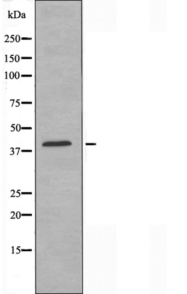 Herpes Simplex Virus Type 1 Antibody in Western Blot (WB)