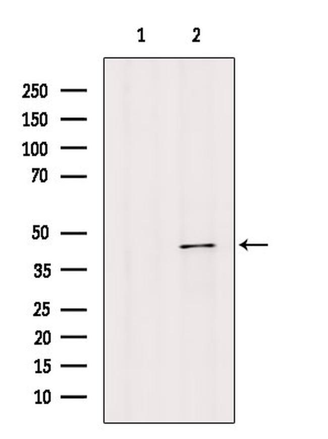 Herpes Simplex Virus Type 1 (strain CL101) Antibody in Western Blot (WB)