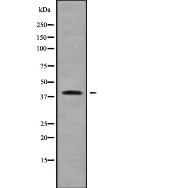 Herpes Simplex Virus Type 1 (strain HFEM) Antibody in Western Blot (WB)