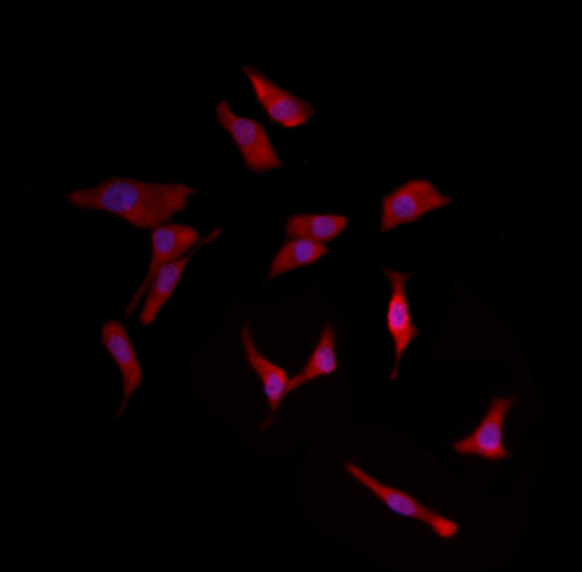 Herpes Simplex Virus Type 1 (strain SC16) Antibody in Immunocytochemistry (ICC/IF)