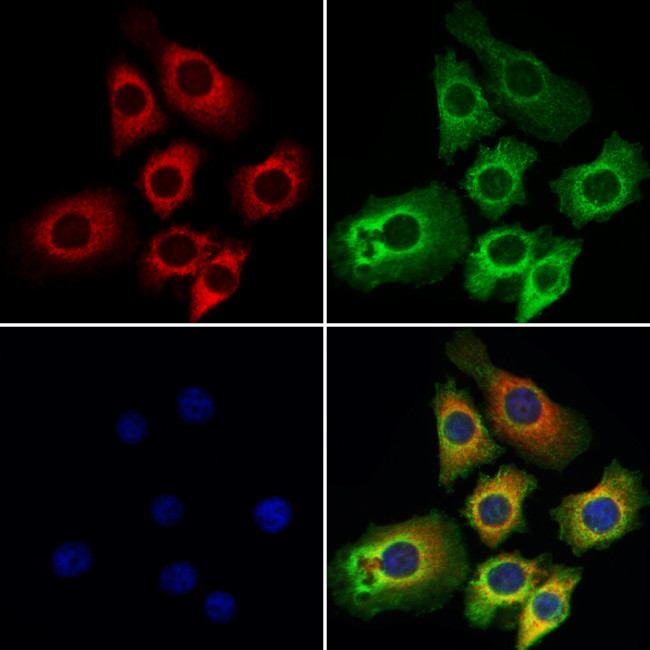 Varicella zoster Virus (strain Dumas) Antibody in Immunocytochemistry (ICC/IF)