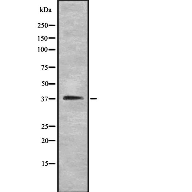 Varicella zoster Virus (strain Dumas) Antibody in Western Blot (WB)