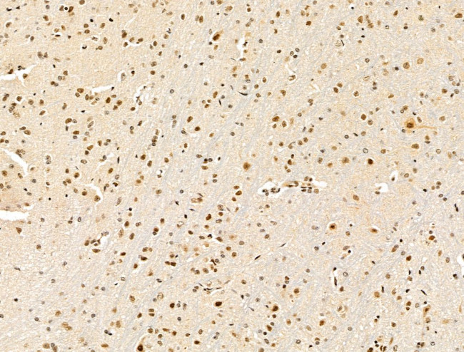 KLF2 Antibody in Immunohistochemistry (Paraffin) (IHC (P))