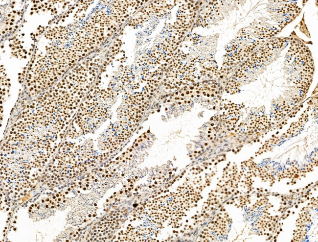 KLF2 Antibody in Immunohistochemistry (Paraffin) (IHC (P))