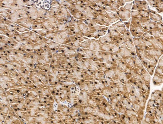 KLF2 Antibody in Immunohistochemistry (Paraffin) (IHC (P))