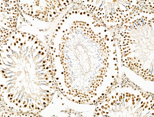 KLF2 Antibody in Immunohistochemistry (Paraffin) (IHC (P))