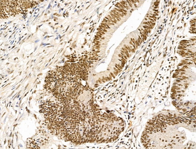 KLF2 Antibody in Immunohistochemistry (Paraffin) (IHC (P))