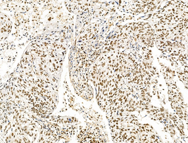 KLF2 Antibody in Immunohistochemistry (Paraffin) (IHC (P))