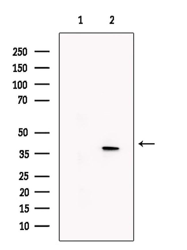 KLF2 Antibody in Western Blot (WB)