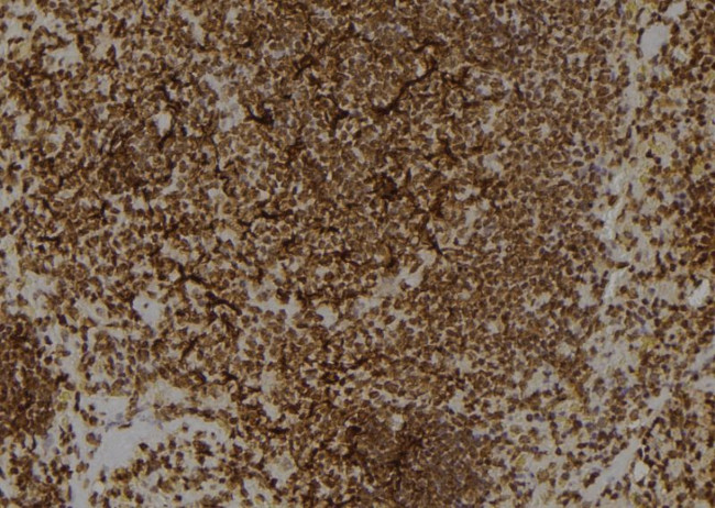 Kallikrein 1 Antibody in Immunohistochemistry (Paraffin) (IHC (P))