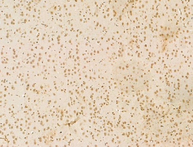 SETDB1 Antibody in Immunohistochemistry (Paraffin) (IHC (P))