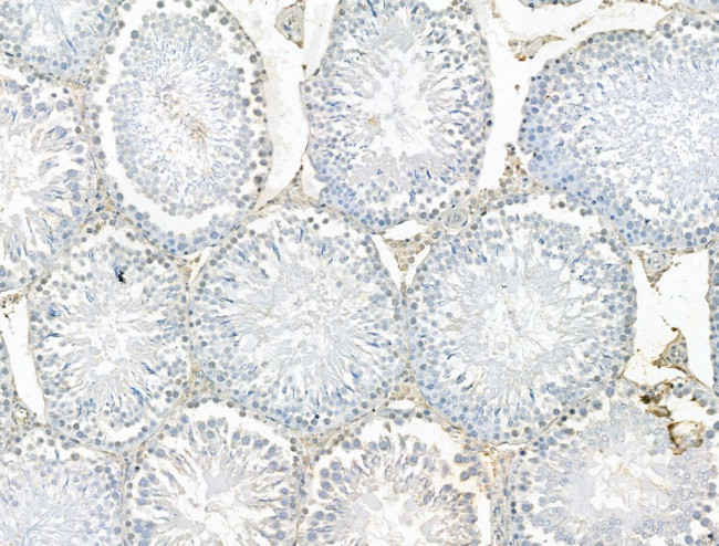 SETDB1 Antibody in Immunohistochemistry (Paraffin) (IHC (P))