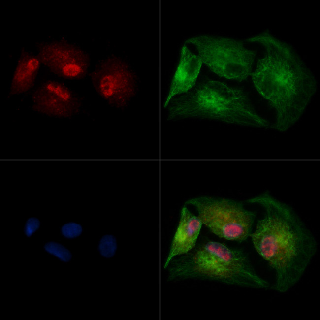 SUV420H2 Antibody in Immunocytochemistry (ICC/IF)