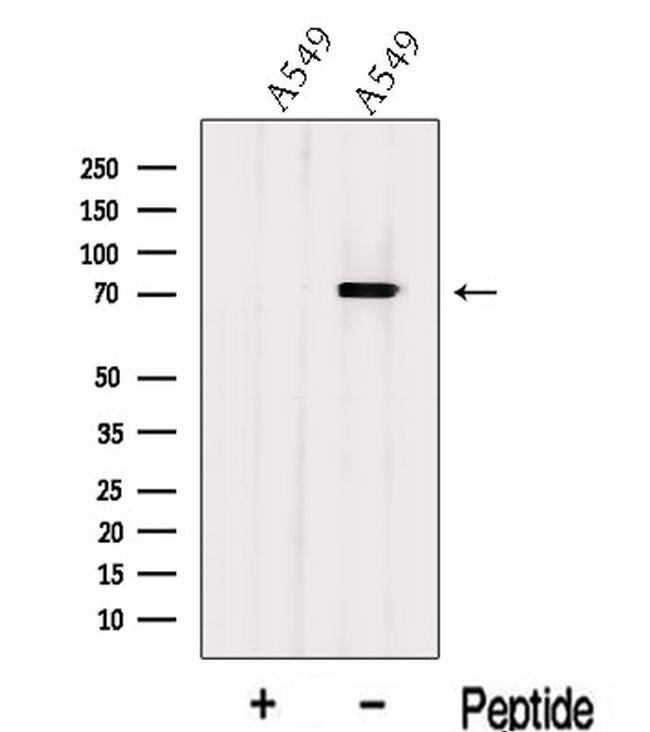 KV1.3 (KCNA3) Antibody in Western Blot (WB)