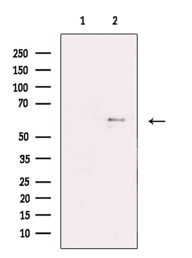 KV1.6 (KCNA6) Antibody in Western Blot (WB)