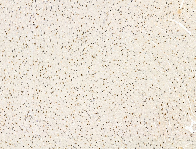 L3MBTL1 Antibody in Immunohistochemistry (Paraffin) (IHC (P))