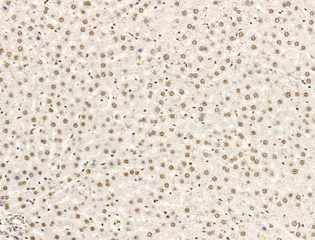 L3MBTL1 Antibody in Immunohistochemistry (Paraffin) (IHC (P))