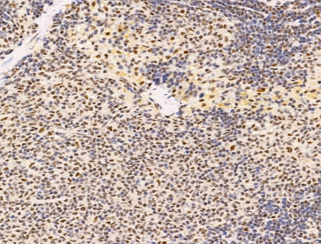 L3MBTL1 Antibody in Immunohistochemistry (Paraffin) (IHC (P))