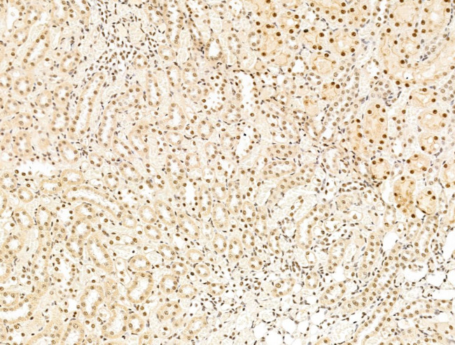 L3MBTL1 Antibody in Immunohistochemistry (Paraffin) (IHC (P))