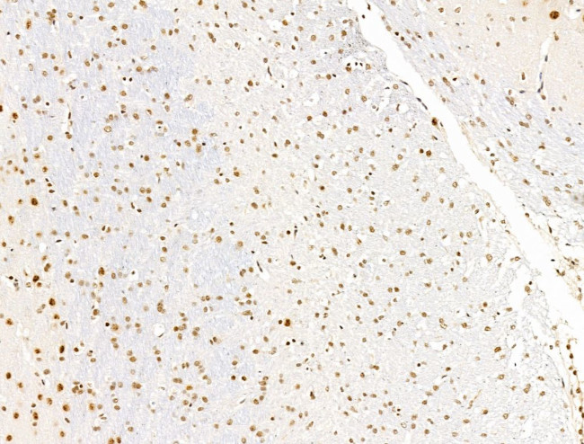 L3MBTL1 Antibody in Immunohistochemistry (Paraffin) (IHC (P))