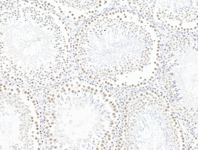 L3MBTL1 Antibody in Immunohistochemistry (Paraffin) (IHC (P))