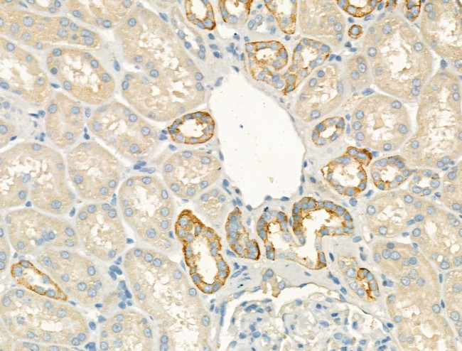 Laminin Antibody in Immunohistochemistry (Paraffin) (IHC (P))