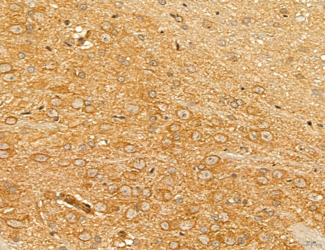 LARS2 Antibody in Immunohistochemistry (Paraffin) (IHC (P))