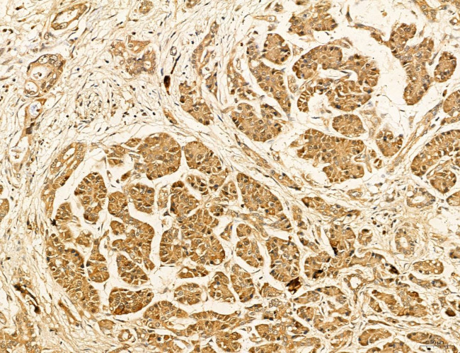 LARS2 Antibody in Immunohistochemistry (Paraffin) (IHC (P))