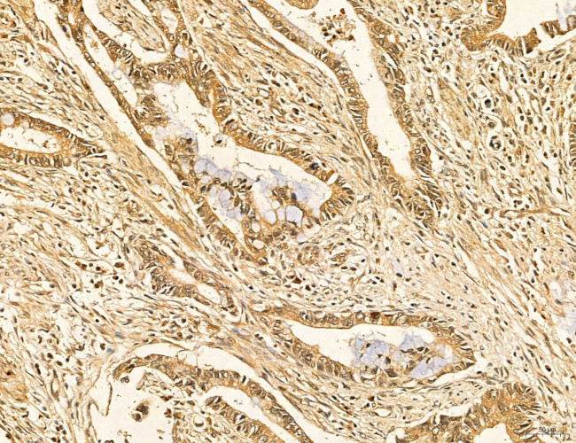 LARS2 Antibody in Immunohistochemistry (Paraffin) (IHC (P))