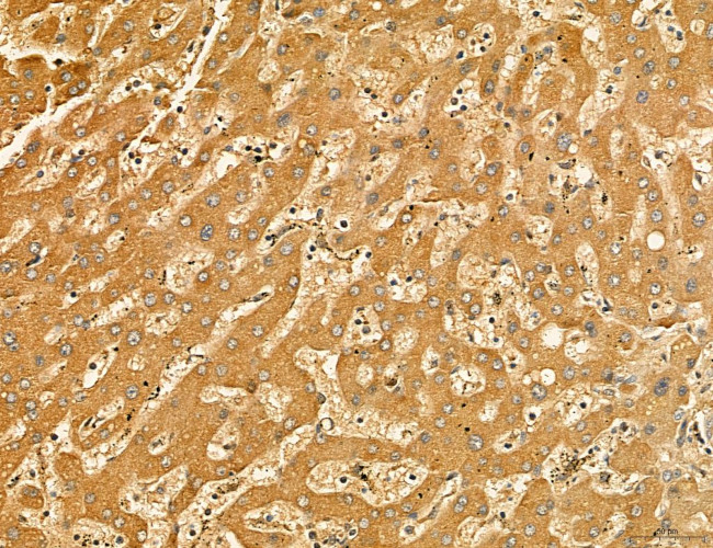 LARS2 Antibody in Immunohistochemistry (Paraffin) (IHC (P))