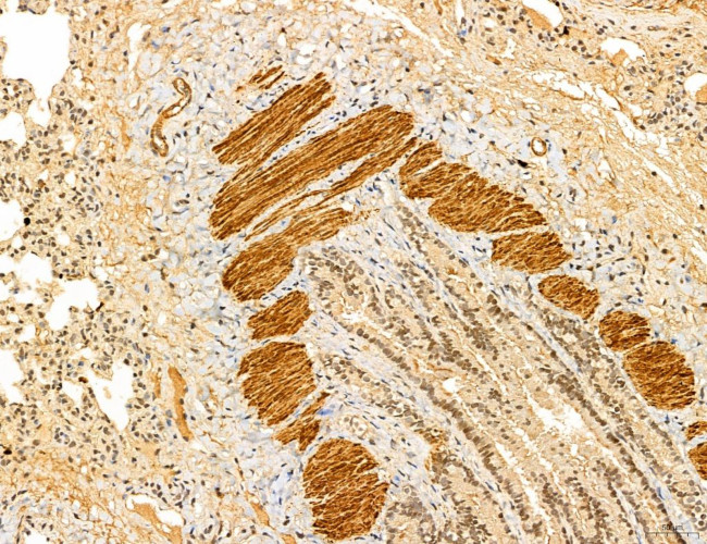 LARS2 Antibody in Immunohistochemistry (Paraffin) (IHC (P))