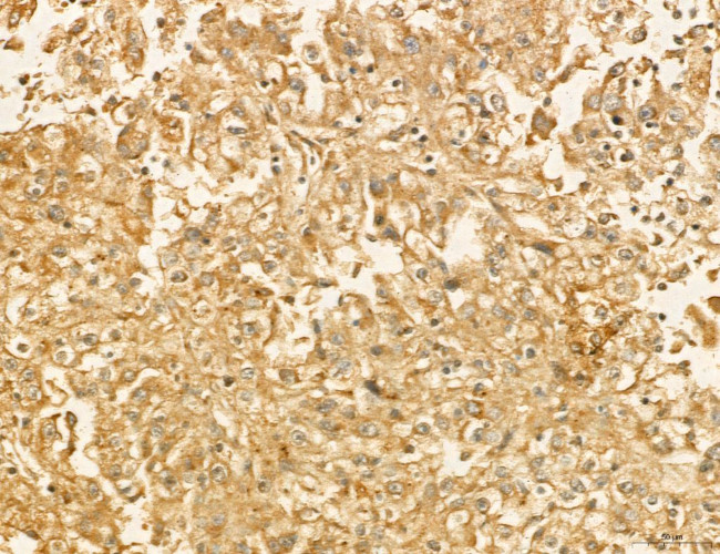 LARS2 Antibody in Immunohistochemistry (Paraffin) (IHC (P))