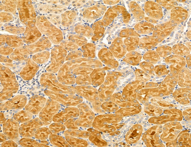 LARS2 Antibody in Immunohistochemistry (Paraffin) (IHC (P))