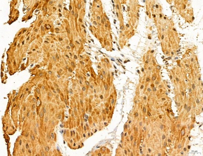 LARS2 Antibody in Immunohistochemistry (Paraffin) (IHC (P))