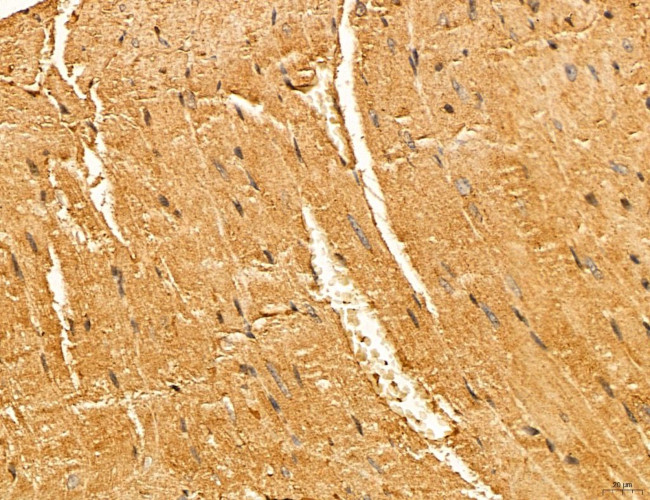 LARS2 Antibody in Immunohistochemistry (Paraffin) (IHC (P))