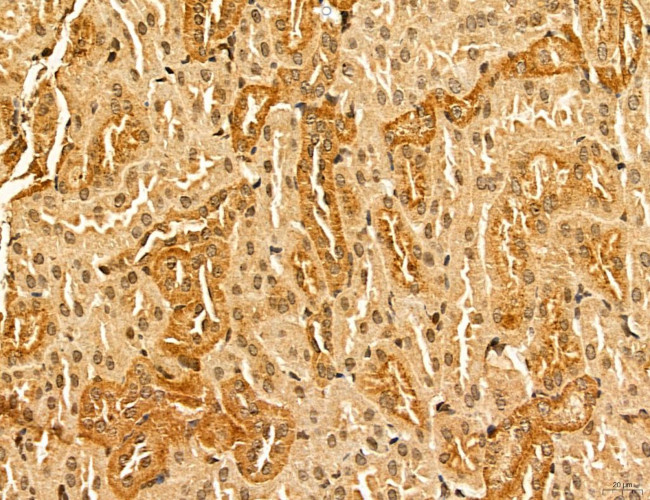 LARS2 Antibody in Immunohistochemistry (Paraffin) (IHC (P))