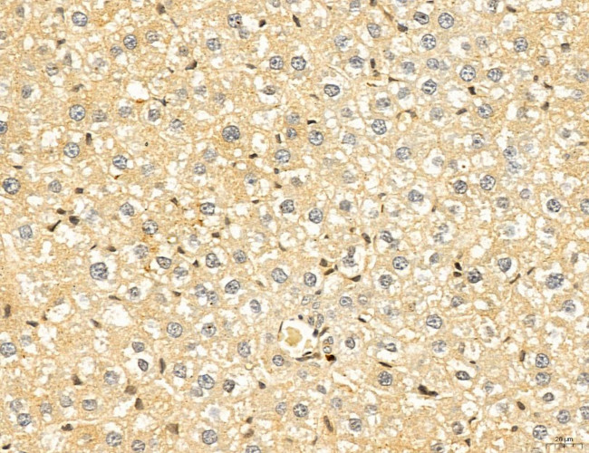 LARS2 Antibody in Immunohistochemistry (Paraffin) (IHC (P))